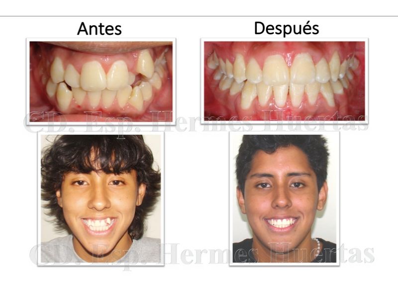 ortodoncista en lima